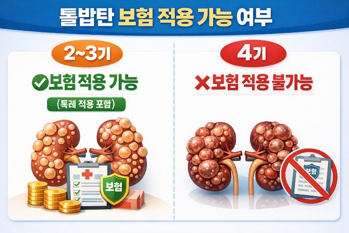 톨밥탄 보험 적용 여부를 2~3기 가능, 4기 불가능으로 비교한 인포그래픽